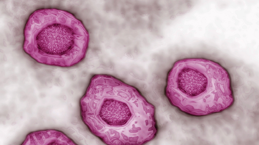 دراسة تكشف قدرة فيروس شائع على التسبب في مرض التصلب المتعدد!