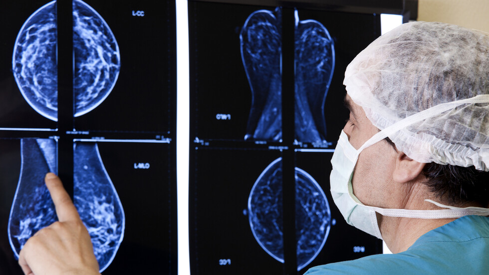 باحثون يحددون مخاطر بروز "الثدي" لدى الرجل