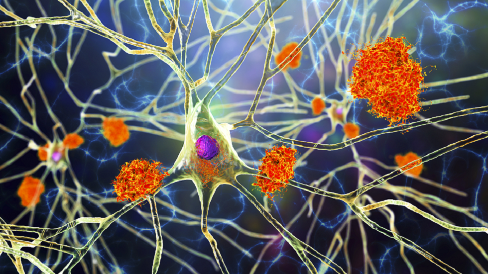 دراسة واعدة تكشف كيفية "استرجاع" الذاكرة لدى بعض مرضى الخرف!
