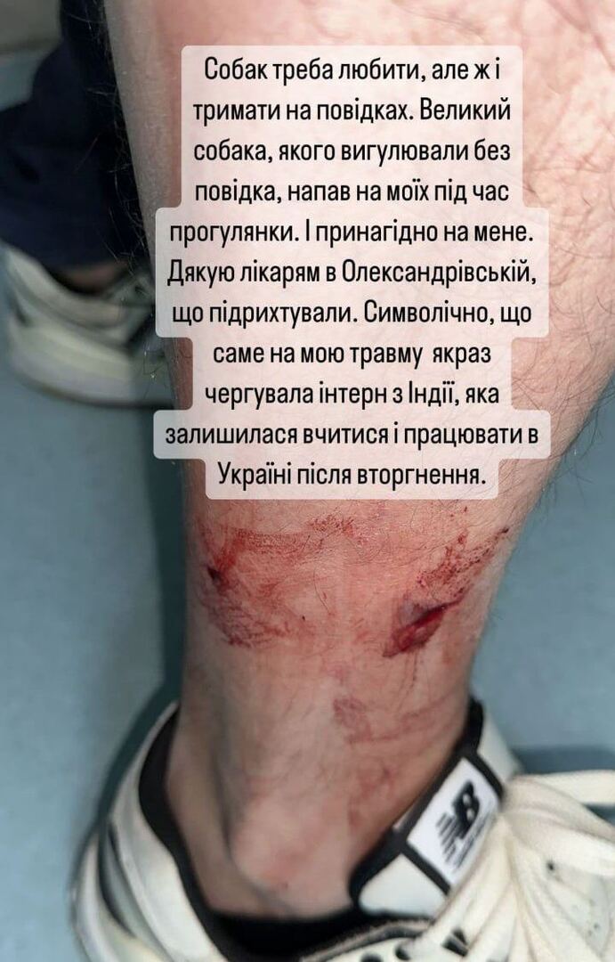 كلب يعض وزير الخارجية الأوكراني ويترك في رجله جروحا غائرة (صورة)