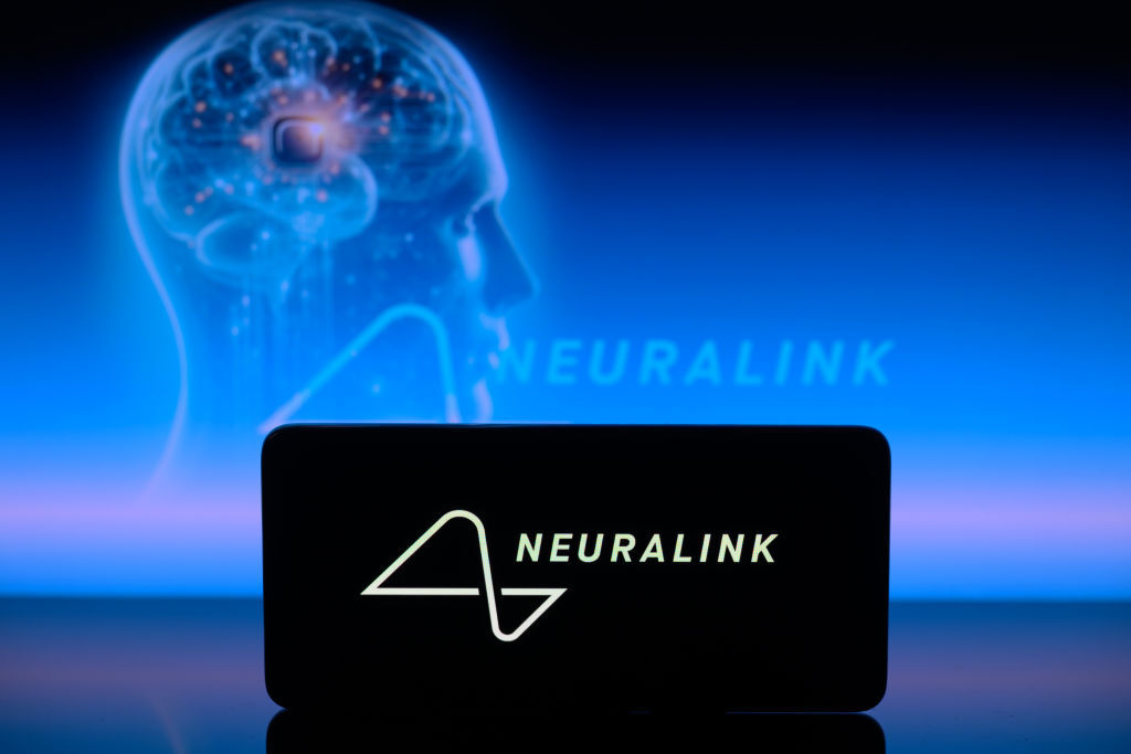 ماسك يؤكد قدرة أول حاصل على شريحة Neuralink الدماغية على تحريك فأرة كمبيوتر بأفكاره فقط