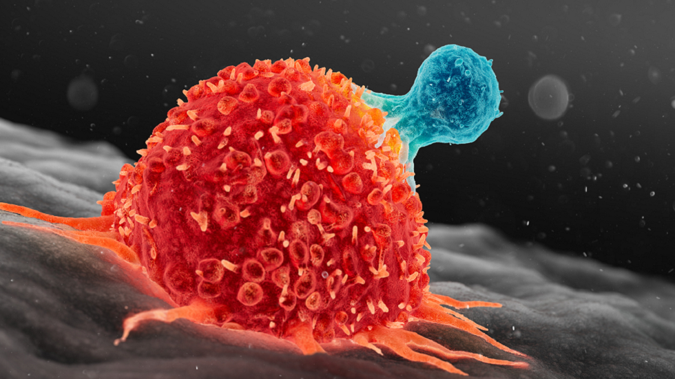 اكتشاف ثوري .. تحديد آلية اختباء الخلايا السرطانية في مراحلها المبكرة