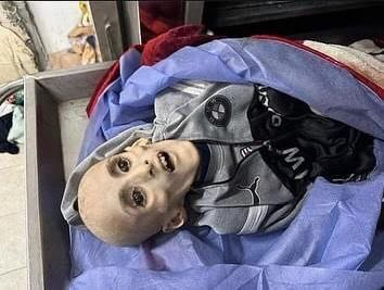صور تقشعر لها الأبدان وتدمي القلب لطفل توفي بسبب سوء التغذية إثر الحصار الإسرائيلي على غزة (صور)