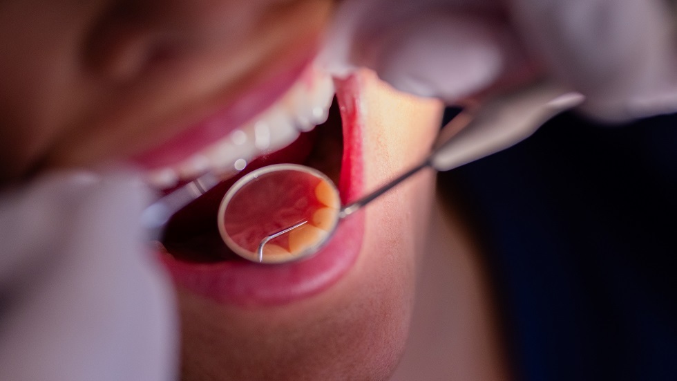 طبيبة: تسوس الأسنان قد يسبب مضاعفات مرضية خطيرة