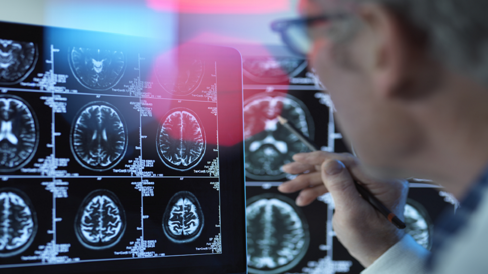 الأول في العالم.. 