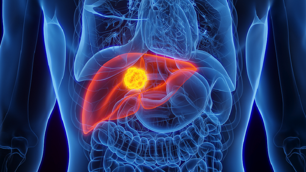 "ابتكار مهم" يمنع انتشار السرطان و"ينهي" عذاب العلاج الكيميائي
