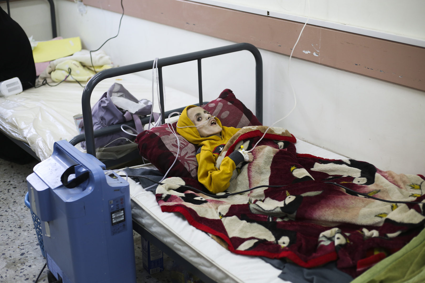 جهاز الإحصاء الفلسطيني: 31 وفاة على الأقل جراء سوء التغذية والجفاف في غزة