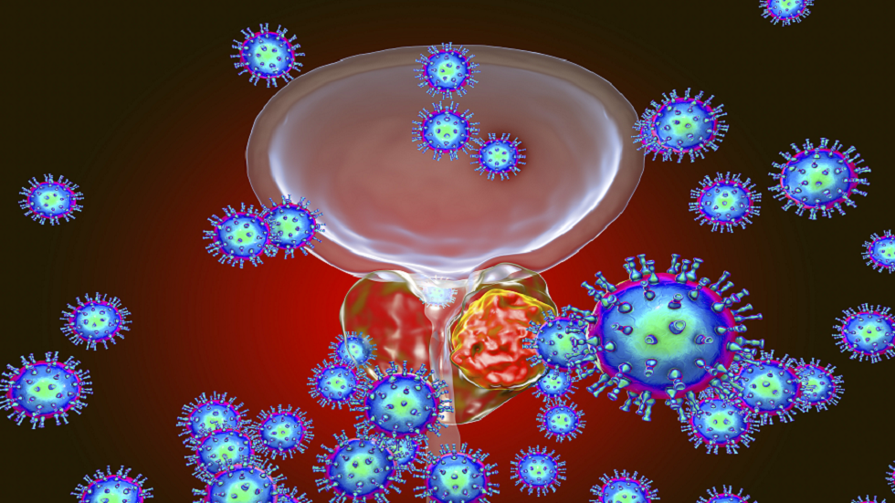 تحديد "الدليل القاطع" على تطوّر وانتشار سرطان البروستات