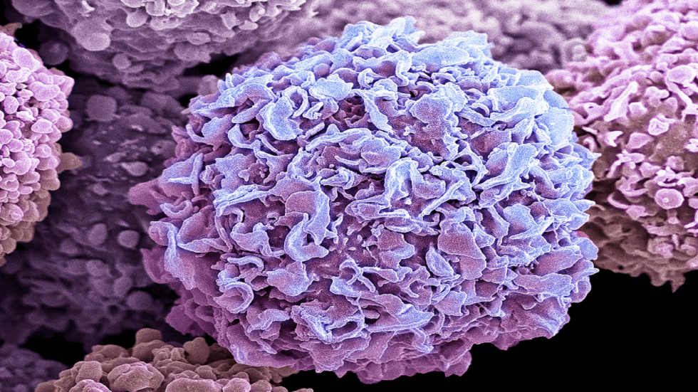 كيفية الوقاية من سرطان الثدي