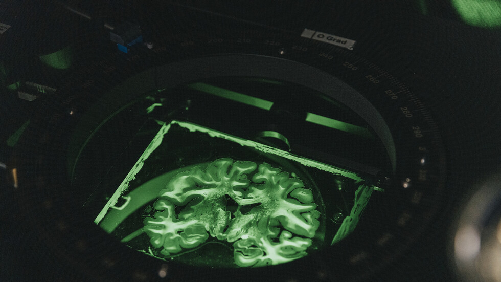 إنجاز رائد.. إنشاء أول دماغ صغير في العالم مزود بحاجز دموي دماغي وظيفي