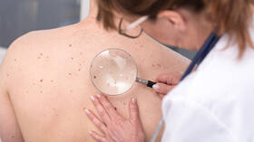 فيديو مثير يكشف كيف تتحول بقعة صغيرة 