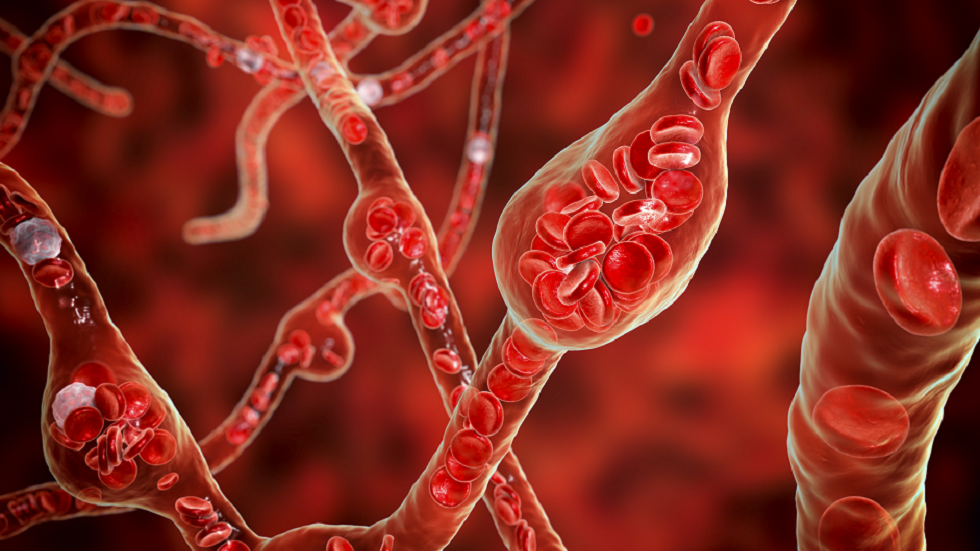 دراسة: أدوية شائعة لضغط الدم قد تزيد خطر النزيف