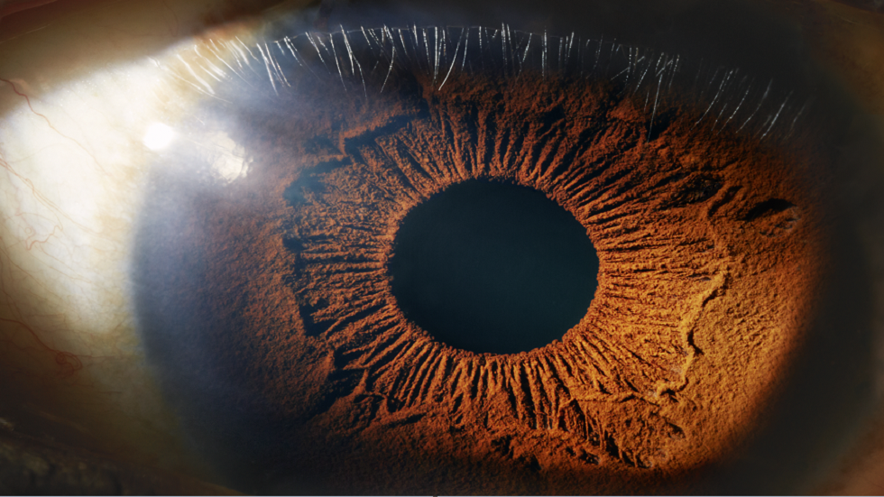 علامات في العين قد تدل على أمراض مزمنة