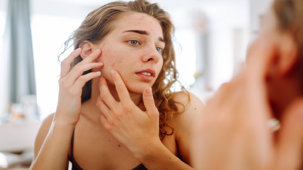 فاكهة لذيذة يمكن أن تساعد في مقاومة حب الشباب