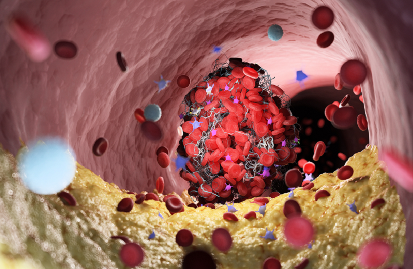 أطعمة صحية تحد من نسبة الكولسترول في الدم