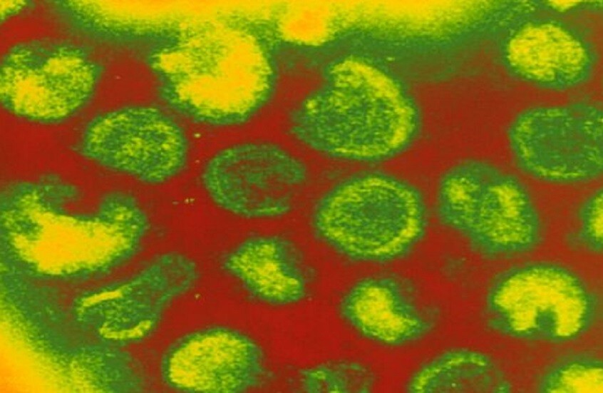 رومانيا تسجل 503 إصابات جديدة بالحصبة خلال أسبوع