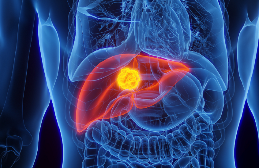 اكتشاف هام في مجال تطوير لقاحات السرطان