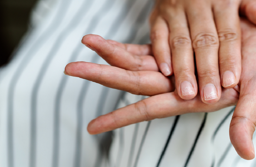 دلالات شكل الظفر ولونه