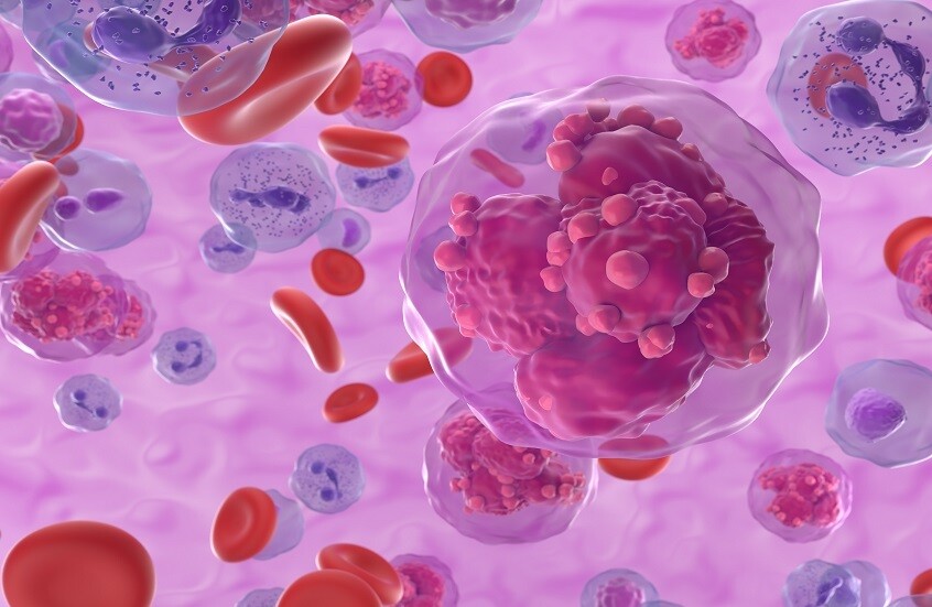 روسيا.. تطوير تقنيات ذكاء اصطناعي لتحديد مستويات الكريات البيضاء في الدم