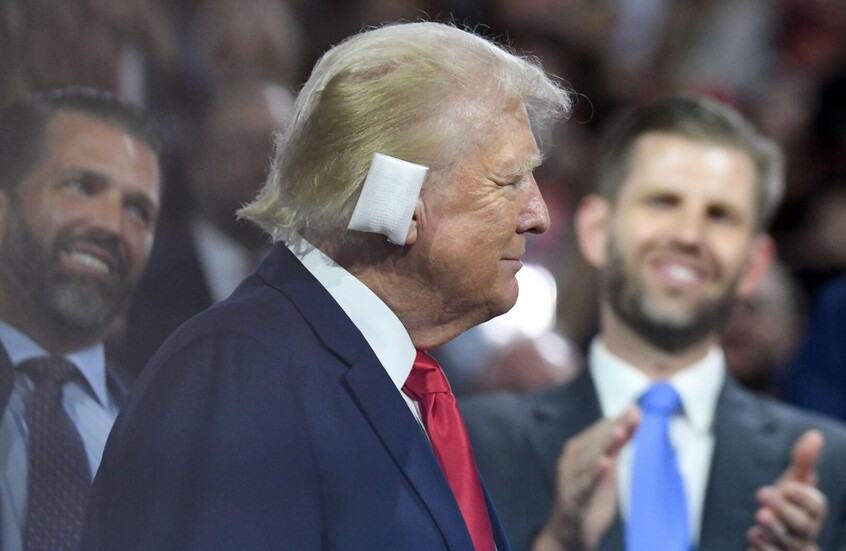 طبيب ترامب يؤكد إصابته برصاصة ويرفض الفرضيات الأخرى