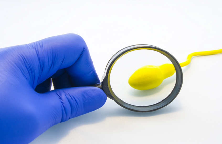 ابتكار يتنبأ بخطر العقم عند الذكور دون اختبار السائل المنوي