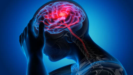 نهج صحي جديد يساعد مرضى السكتة الدماغية على استعادة الحركة
