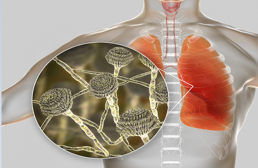 فطر قاتل يجتاح أراضي الولايات المتحدة