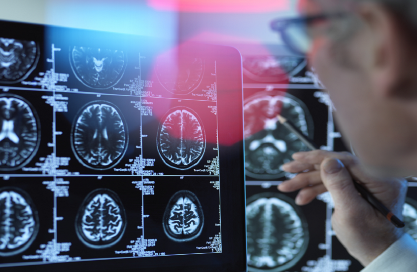 ممارسة شائعة وممتعة قد تزيد خطر الإصابة بالخرف