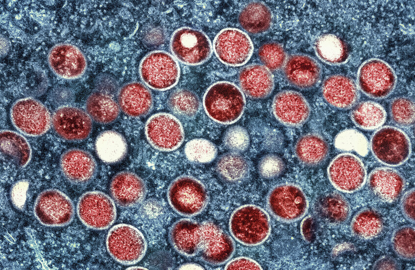 الأمم المتحدة تطلب تخصيص 18.5 مليون دولار لتقديم مساعدة عاجلة لمرضى جدري القردة في إفريقيا