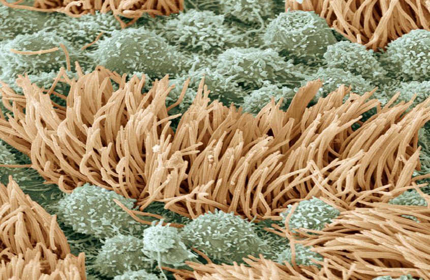 ما تأثير لزوجة السوائل في الجهاز التناسلي الأنثوي على الخصوبة؟