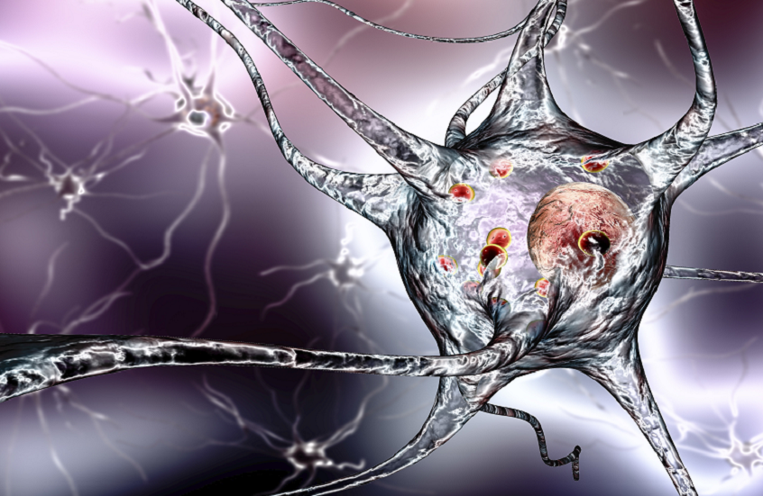 تحديد 4 مؤشرات رئيسية للتدهور الإدراكي