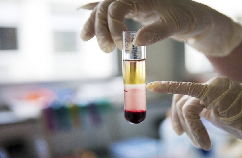 العلماء يعلنون عن اختراق في علاج أمراض الدم