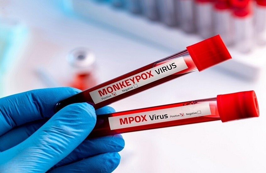 جدري القردة يتسلل إلى أكبر دولة سكانيا