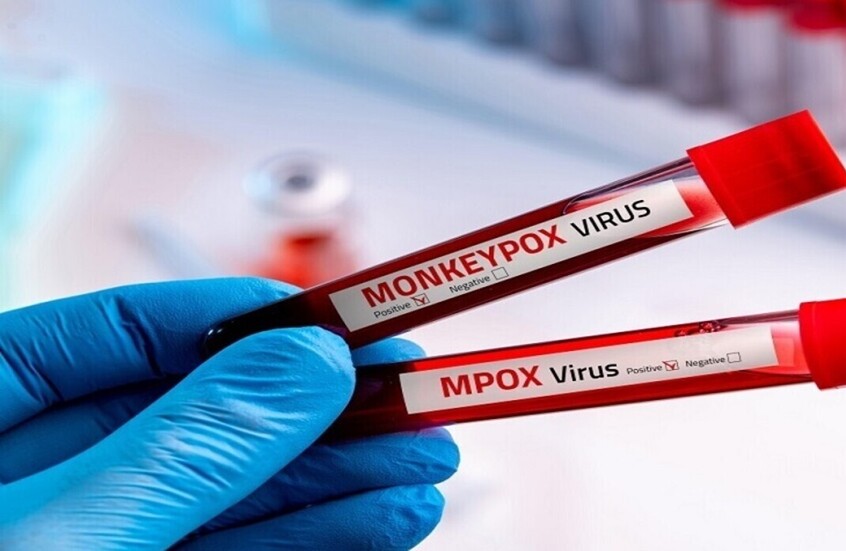 طبيب روسي: حدثت طفرة في فيروس جدري القردة تغير التصورات حول انتشاره