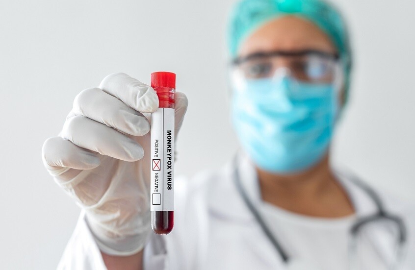 دولة آسيوية تسجل أول حالة إصابة بمرض"جدري القردة" سريع الانتشار