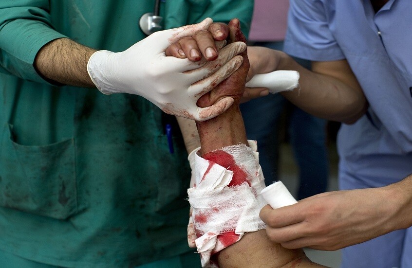 العلماء الروس يستخدمون الفيروسات في علاج جروح الطلقات النارية