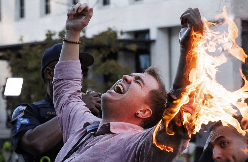 صحفي أمريكي "يضحي" بيده اليسرى لأطفال غزة (فيديو)