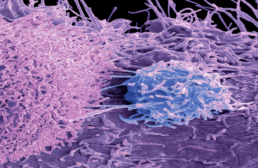 اكتشاف علاج جديد محتمل لسرطان بروستات عدواني