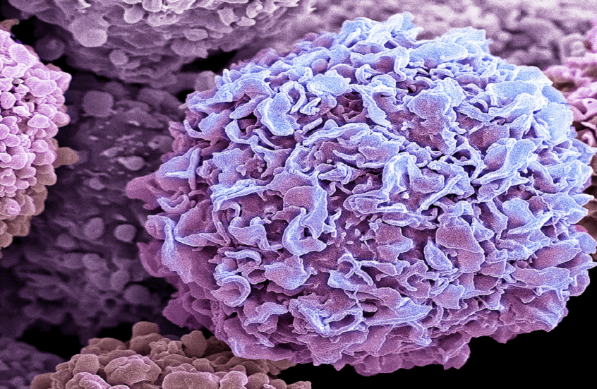 تجربة تثير تساؤلات أخلاقية.. باحثة تخاطر بحياتها وتهزم السرطان باستخدام الفيروسات