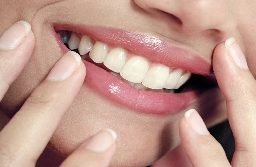 بين عمر 20 إلى 60 عاما.. التغيرات التي تطرأ على الأسنان بمرور الزمن