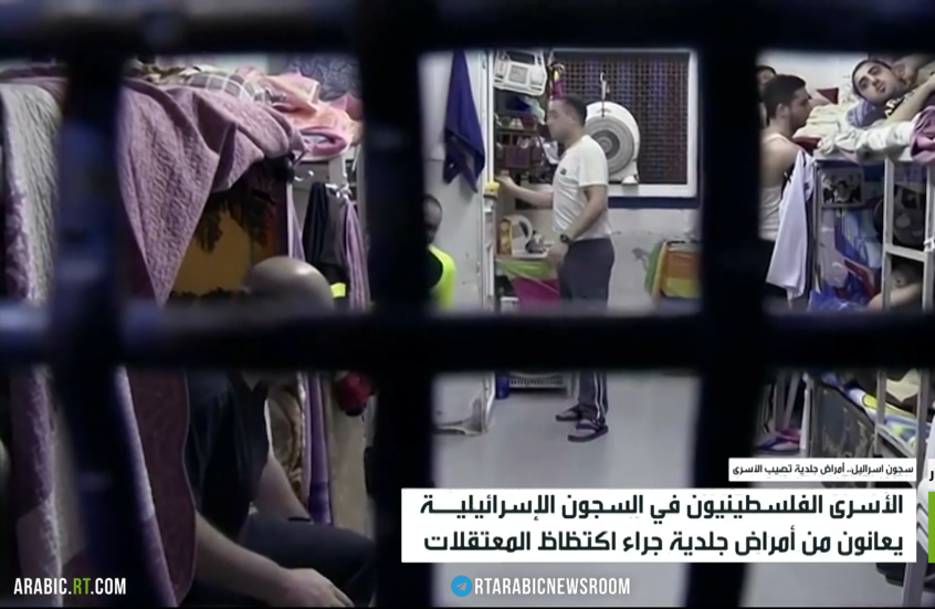 سجون إسرائيل.. أمراض جلدية تصيب الأسرى