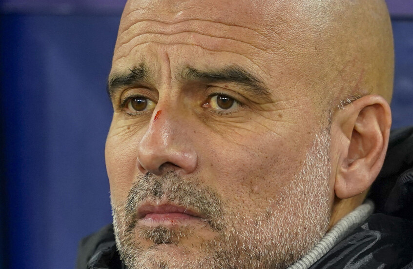 سر الجروح على وجه غوارديولا بعد تعادل مانشستر سيتي أمام فينورد