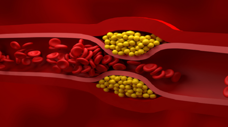 "غذاء مثالي" يساعد على تقليل الكوليسترول الضار عند تناوله يوميا 