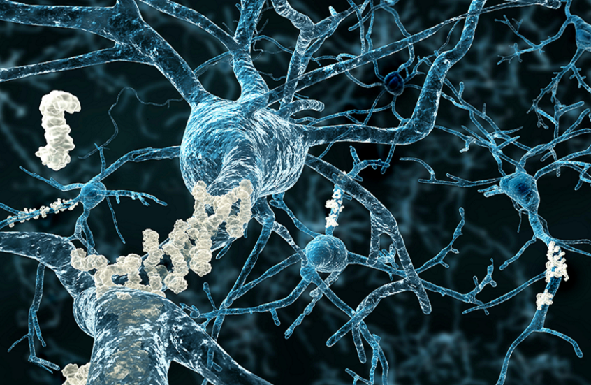 اكتشاف 13 بروتينا مرتبطا بشيخوخة الدماغ
