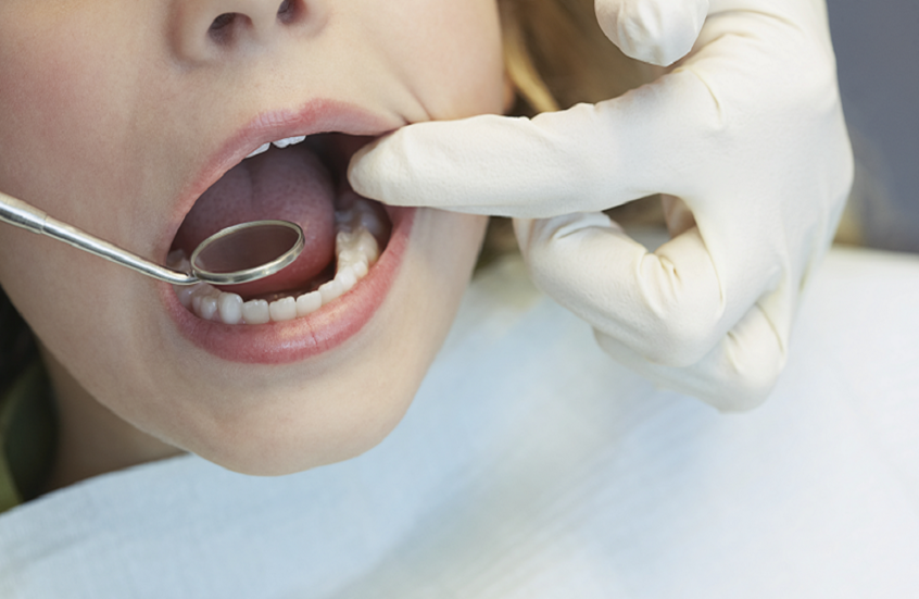 فحص صحة الفم قد ينقذ حياتك من أمراض مميتة