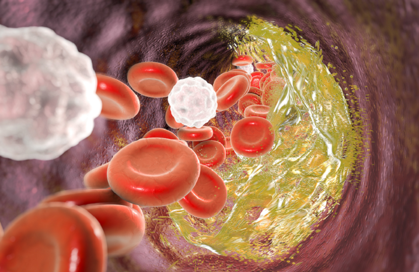 اكتشاف قد يغير المفهوم التقليدي للكوليسترول "الجيد"