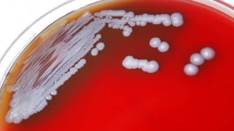 خبير يدق ناقوس الخطر بشأن بكتيريا خطيرة