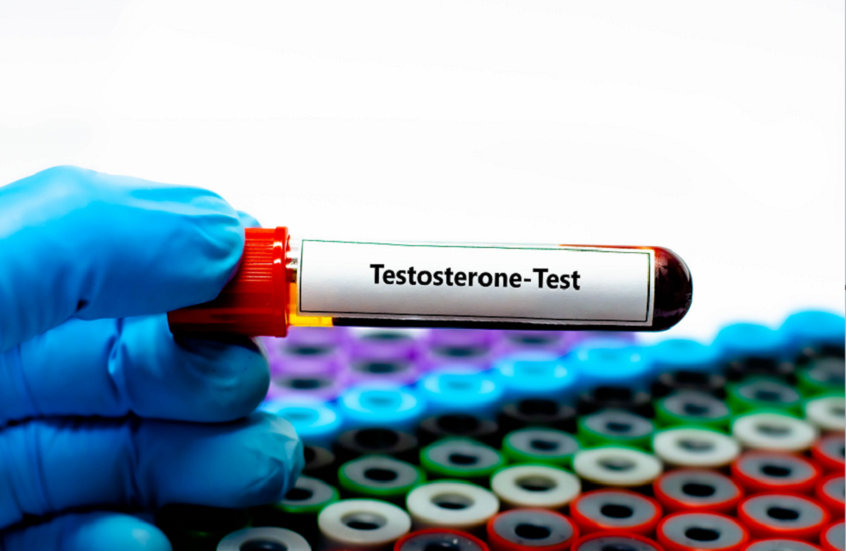 علامات نقص هرمون التستوستيرون لدى الرجال