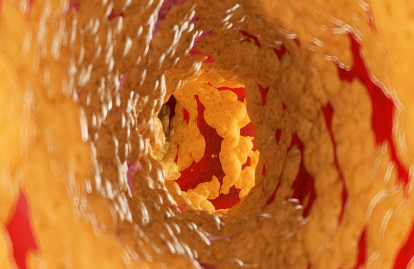 خلال شهر!.. وجبة لذيذة يمكنها خفض الكوليسترول الضار