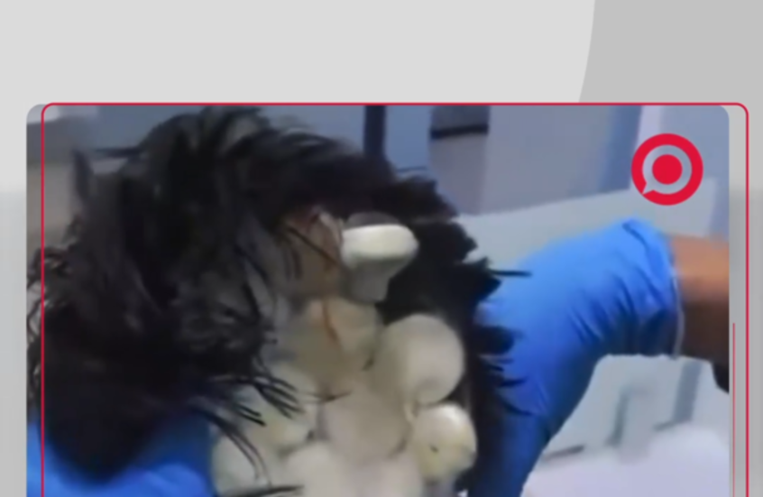 الشرطة الكولومبية تكشف كمية من الكوكايين مخبأة في رأس مسافر